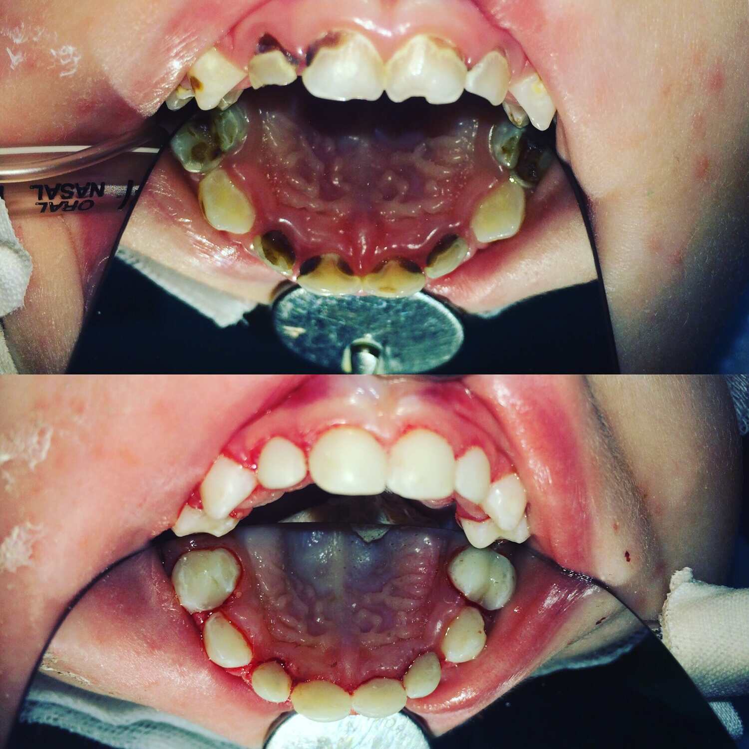Лечение зубов Томск Беринга Протезирование на имплантах Томск Военный